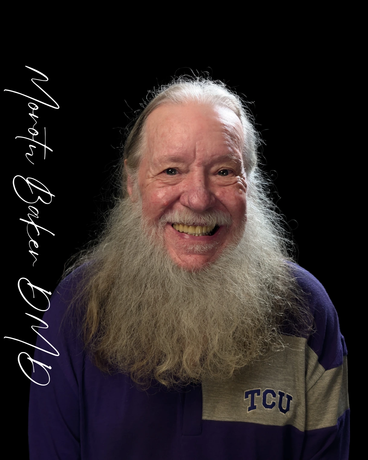 Tommy, a real Dr. Baker patient, after fixed implant teeth