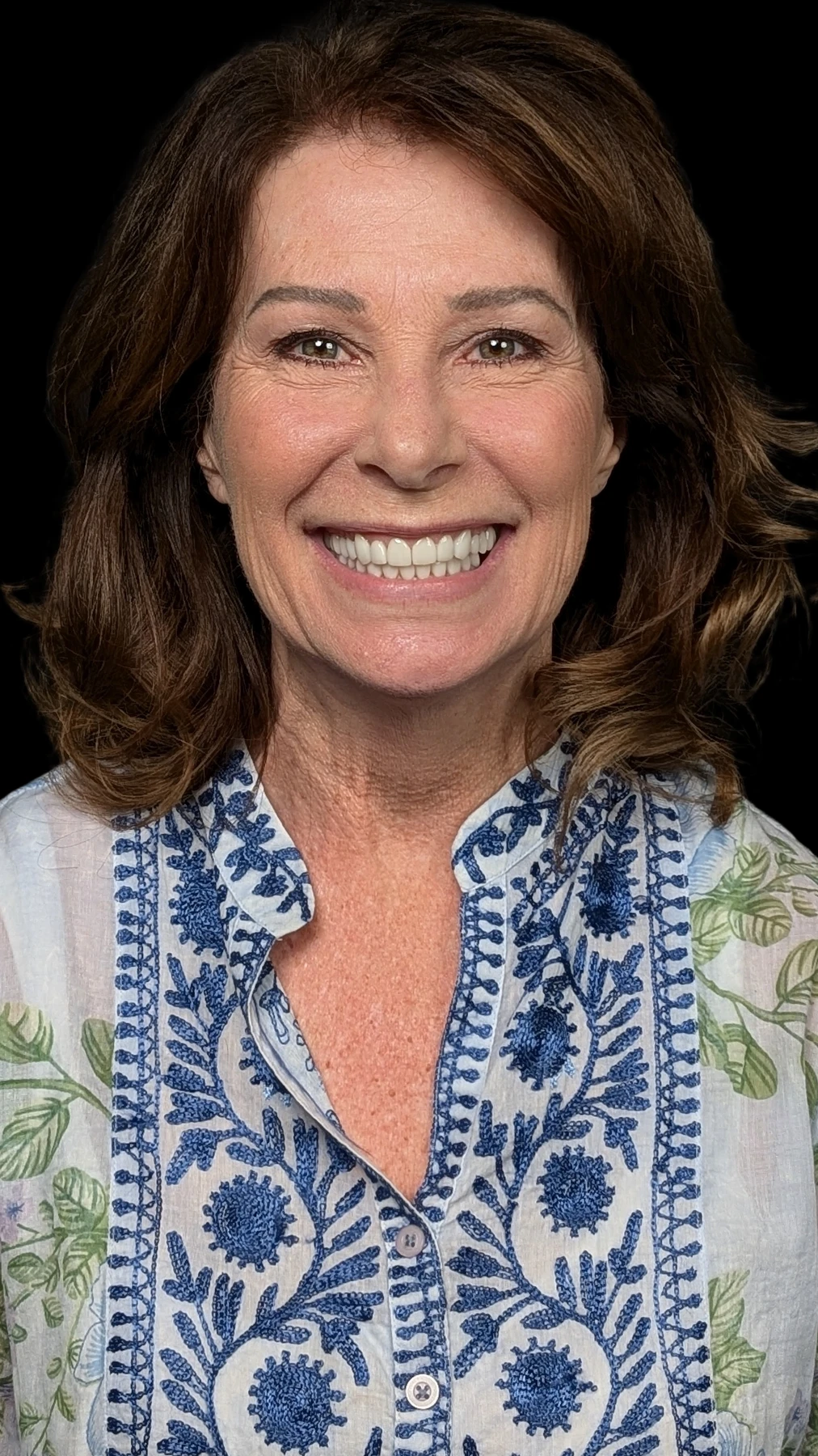A real Dr. Baker patient smiling after her new smile
